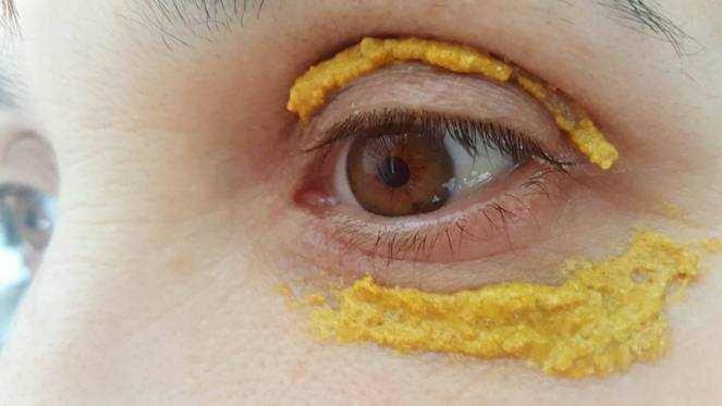 She Started Applying Turmeric Around Her Eyes, 10 Minutes Later Unbelievable