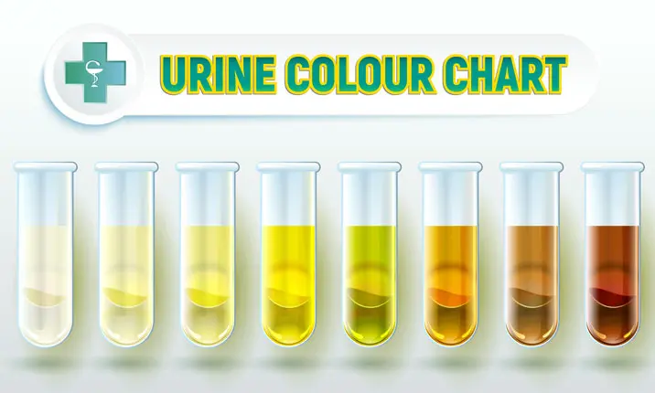 What The Color Of Your Urine Says About Your Health